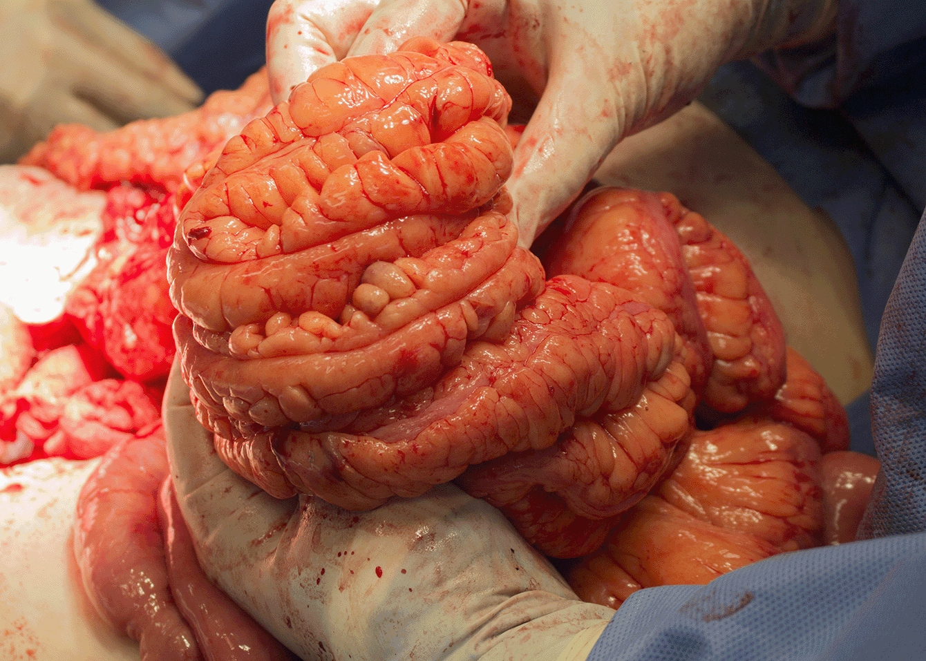 Disease-focused mesentery investigation image