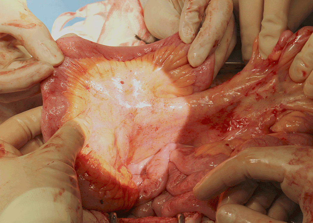 Intraoperative video analysis frame