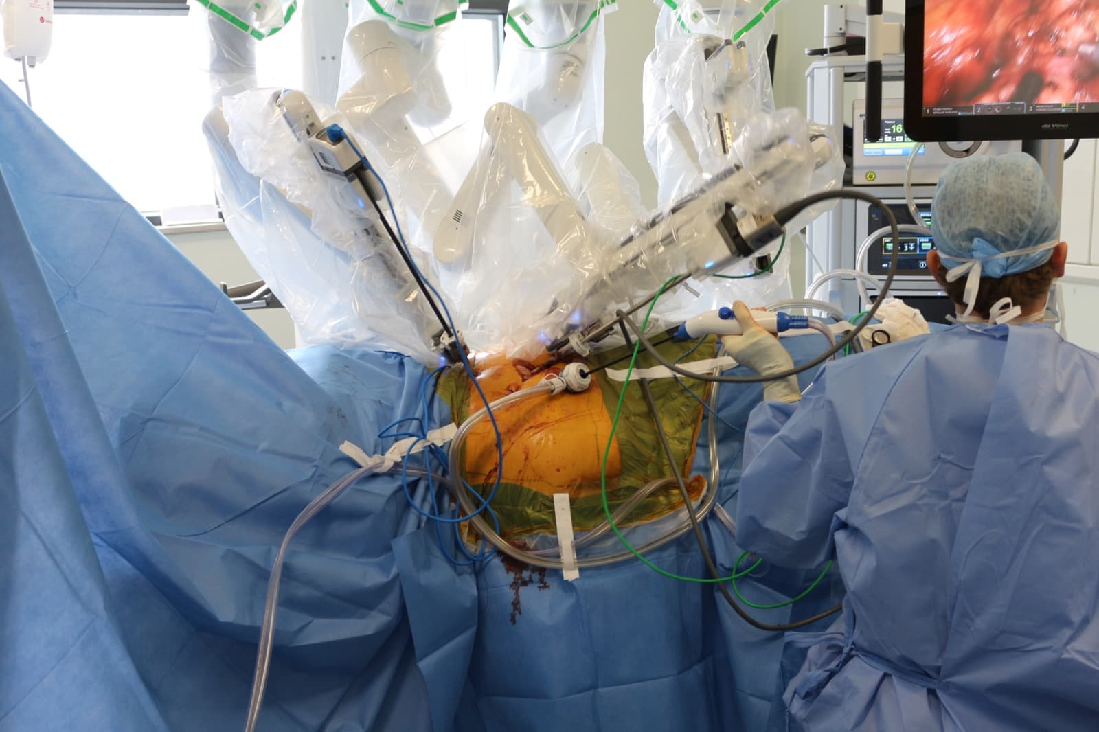 Robotic surgery theatre context