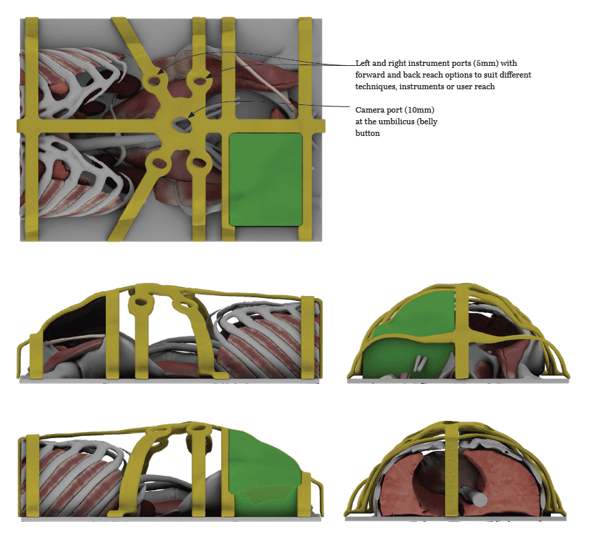 Final concept anatomical surgical simulator 2